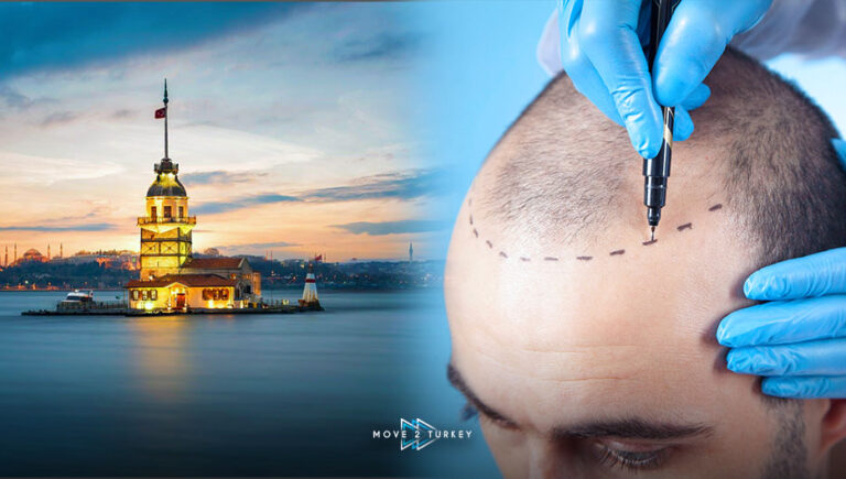 What Makes Turkey Renowned for Hair Transplants? A complete guide